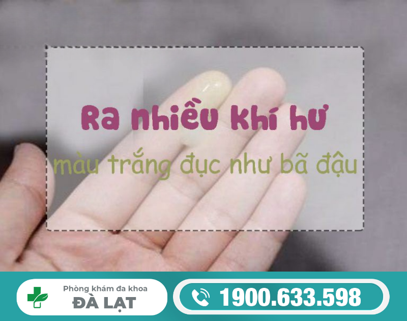 Hình ảnh minh họa